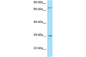 Western Blotting (WB) image for anti-Tumor Necrosis Factor Receptor Superfamily, Member 13B (TNFRSF13B) (N-Term) antibody (ABIN2789582) (TACI anticorps  (N-Term))