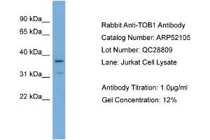WB Suggested Anti-TOB1  Antibody Titration: 0. (Protein Tob1 (TOB1) (Middle Region) anticorps)