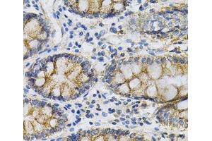 Immunohistochemistry of paraffin-embedded Human colon using PTPRA Polyclonal Antibody at dilution of 1:100 (40x lens). (PTPRA anticorps)