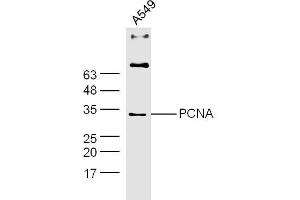 A549 lysates probed with PCNA Polyclonal Antibody, Unconjugated  at 1:300 dilution and 4˚C overnight incubation. (PCNA anticorps  (AA 185-261))