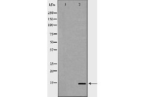 Western blot analysis of K562 whole cell lysates, using GYPC Antibody.
