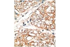 Image no. 2 for anti-BCL2-Related Ovarian Killer (BOK) (BH3 Domain), (N-Term) antibody (ABIN356820) (BOK anticorps  (BH3 Domain, N-Term))