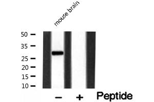 Western blot analysis of MMP7 expression in Mouse brain lysate