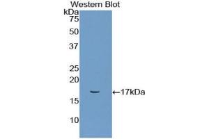 Detection of Recombinant CD72, Rat using Polyclonal Antibody to Cluster Of Differentiation 72 (CD72) (CD72 anticorps  (AA 126-237))
