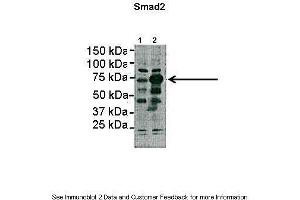 Lanes:   Lane1: 2ug HEK293lysate Lane2: 2ug SMAD2 transfected HEK293 lysate  Primary Antibody Dilution:   1:1000  Secondary Antibody:   Anti-rabbit HRP  Secondary Antibody Dilution:   1:5000  Gene Name:   SMAD2  Submitted by:   Dominique Alfandari, University of Massachusetts