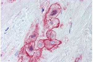 Human Placenta (formalin-fixed, paraffin-embedded) stained with MCAM antibody ABIN462314 followed by biotinylated goat anti-rabbit IgG secondary antibody ABIN481713, alkaline phosphatase-streptavidin and chromogen.