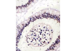 (ABIN6243085 and ABIN6578223) staining CTCF in human colon tissue sections by Immunohistochemistry (IHC-P - paraformaldehyde-fixed, paraffin-embedded sections). (CTCF anticorps  (AA 334-364))