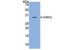 Detection of Recombinant ARRb1, Human using Polyclonal Antibody to Arrestin Beta 1 (ARRb1)