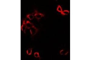 Immunofluorescent analysis of GFRA1 staining in SW480 cells. (GFRA1 anticorps)