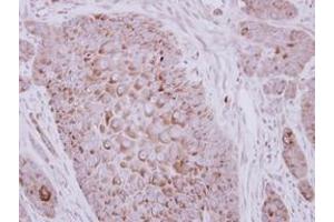 Image no. 1 for anti-Zona Pellucida Glycoprotein 2 (ZP2) (AA 1-313) antibody (ABIN1501855)