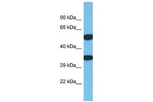 Host: Rabbit Target Name: TMEM68 Sample Type: Jurkat Whole Cell lysates Antibody Dilution: 1. (TMEM68 anticorps  (N-Term))