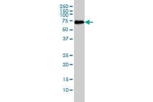 CDK5RAP3 monoclonal antibody (M01), clone 1G4 Western Blot analysis of CDK5RAP3 expression in A-431 . (CDK5RAP3 anticorps  (AA 1-506))