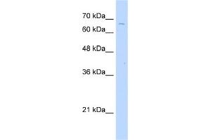 WB Suggested Anti-TKTL2 Antibody Titration:  2. (TKTL2 anticorps  (C-Term))