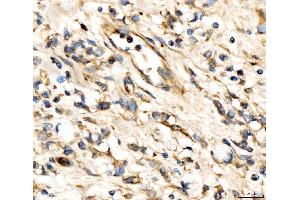 IHC analysis of AP2A2 using anti-AP2A2 antibody (ABIN7602295).