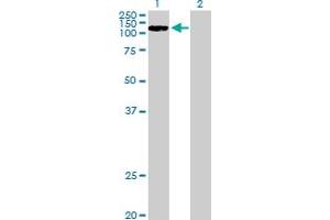 Western Blot analysis of CCDC66 expression in transfected 293T cell line by CCDC66 MaxPab polyclonal antibody. (CCDC66 anticorps  (AA 1-831))
