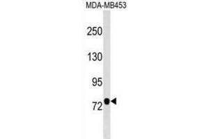 Western Blotting (WB) image for anti-Chromosome 9 Open Reading Frame 3 (C9orf3) antibody (ABIN2999510) (C9orf3 anticorps)