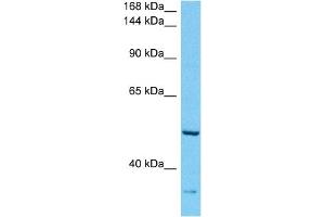 Host:  Rabbit  Target Name:  ABCA10  Sample Tissue:  Human Esophagus Tumor lysates  Antibody Dilution:  1ug/ml (ABCA10 anticorps  (C-Term))