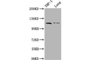 Western Blot Positive WB detected in: THP-1 whole cell lysate, Mouse lung tissue All lanes: MDA5 antibody at 1:2000 Secondary Goat polyclonal to rabbit IgG at 1/50000 dilution Predicted band size: 117, 26 kDa Observed band size: 117 kDa (Recombinant IFIH1 anticorps)