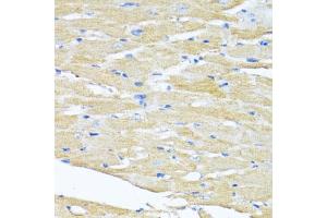 Immunohistochemistry of paraffin-embedded mouse heart using HSD17B1 antibody (ABIN6129829, ABIN6142002, ABIN6142003 and ABIN6215013) at dilution of 1:100 (40x lens).