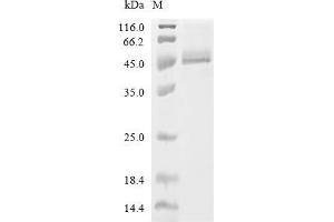 (Tris-Glycine gel) Discontinuous SDS-PAGE (reduced) with 5 % enrichment gel and 15 % separation gel.