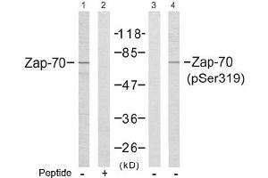 Image no. 2 for anti-zeta-Chain (TCR) Associated Protein Kinase 70kDa (ZAP70) (Tyr319) antibody (ABIN197384) (ZAP70 anticorps  (Tyr319))