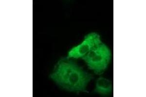 Anti-TACC3 mouse monoclonal antibody (ABIN2453830) immunofluorescent staining of COS7 cells transiently transfected by pCMV6-ENTRY TACC3 (RC210754). (TACC3 anticorps)