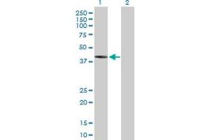 Western Blot analysis of IVD expression in transfected 293T cell line by IVD MaxPab polyclonal antibody. (IVD anticorps  (AA 1-423))