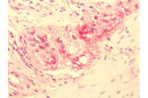 Human Myenteric Plexus Ganglion: Formalin-Fixed, Paraffin-Embedded (FFPE)