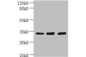 Western blot All lanes: OTUD6B antibody at 4 μg/mL Lane 1: PC-3 whole cell lysate Lane 2: 293T whole cell lysate Lane 3: MDA-MB-231 whole cell lysate Secondary Goat polyclonal to rabbit IgG at 1/10000 dilution Predicted band size: 34, 22 kDa Observed band size: 34 kDa (OTUD6B anticorps  (AA 1-293))