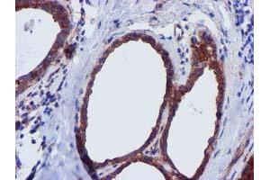 Immunohistochemical staining of paraffin-embedded Human breast tissue using anti-EPN2 mouse monoclonal antibody. (Epsin 2 anticorps)