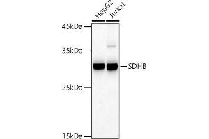 Western blot analysis of extracts of various cell lines, using SDHB antibody (ABIN6131588, ABIN6147472, ABIN6147474 and ABIN6215002) at 1:500 dilution.