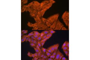Immunofluorescence analysis of U-2 OS cells using SRP54 Rabbit mAb (ABIN3015958, ABIN3015959, ABIN1682276, ABIN1682277 and ABIN7101466) at dilution of 1:100 (40x lens).