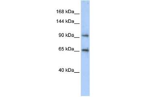 WB Suggested Anti-CCDC52 Antibody Titration: 0. (SPICE1 anticorps  (Middle Region))