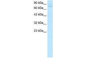 ZNF81 antibody (20R-1073) used at 0. (ZNF81 anticorps  (Middle Region))