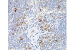 Immunohistochemistry of paraffin-embedded Mouse spleen using TNFRSF13B Polyclonal Antibody at dilution of 1:100 (40x lens). (TACI anticorps)