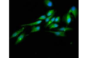 Immunofluorescence staining of Hela cells with ABIN7164423 at 1:100, counter-stained with DAPI. (HECTD2 anticorps  (AA 674-776))