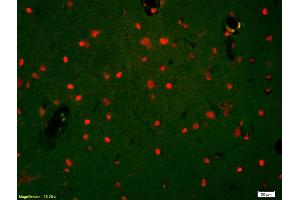 Formalin-fixed and paraffin-embedded rat brain labeled with Anti-HDAC3/HD3 Polyclonal Antibody, Unconjugated (ABIN734903) 1:200, overnight at 4 °C, The secondary antibody was Goat Anti-Rabbit IgG, Cy3 conjugated used at 1:200 dilution for 40 minutes at 37 °C.