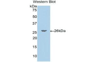 Western Blotting (WB) image for anti-Jagged 1 (JAG1) (AA 33-250) antibody (ABIN1175042) (JAG1 anticorps  (AA 33-250))