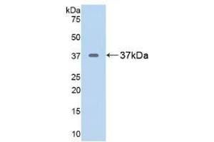 Detection of Recombinant ARG, Rat using Polyclonal Antibody to Arginase (ARG) (ARG anticorps  (AA 1-323))