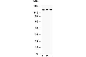 Western blot testing of Insulin Receptor antibody and Lane 1:  rat kidney;  2: PANC;  3: HeLa (Insulin Receptor anticorps  (AA 1353-1372))