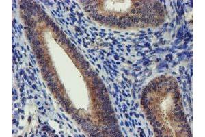 Immunohistochemical staining of paraffin-embedded Human endometrium tissue using anti-DCLRE1B mouse monoclonal antibody. (DCLRE1B anticorps  (AA 1-280))