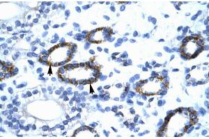 Human kidney; GTF2F2 antibody - C-terminal region in Human kidney cells using Immunohistochemistry (GTF2F2 anticorps  (C-Term))
