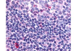 Anti-Thrombin Receptor antibody IHC of human tonsil.