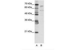 Image no. 1 for anti-TAF6-Like RNA Polymerase II, P300/CBP-Associated Factor (PCAF)-Associated Factor, 65kDa (TAF6L) (N-Term) antibody (ABIN203282) (TAF6L anticorps  (N-Term))