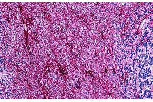 Human Brain, Cerebellum: Formalin-Fixed, Paraffin-Embedded (FFPE) (GFAP anticorps)