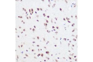 Immunohistochemistry of paraffin-embedded rat brain using S Rabbit pAb (ABIN6128698, ABIN6147392, ABIN6147393 and ABIN6215703) at dilution of 1:100 (40x lens).