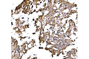 IHC analysis of IRBIT/AHCYL1 using anti-IRBIT/AHCYL1 antibody (ABIN7600030). (AHCYL1 anticorps  (AA 14-57))