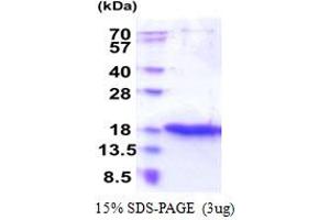 SDS-PAGE (SDS) image for Zymogen Granule Protein 16 (ZG16) (AA 17-167) protein (His tag) (ABIN6387407)
