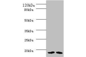 Western blot All lanes: PAM16 antibody at 2 μg/mL Lane 1: HL60 whole cell lysate Lane 2: HepG2 whole cell lysate Secondary Goat polyclonal to rabbit IgG at 1/10000 dilution Predicted band size: 14 kDa Observed band size: 14 kDa (MAGMAS anticorps  (AA 1-125))