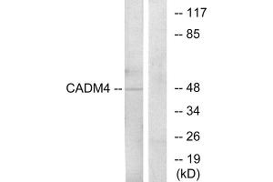 Western blot analysis of extracts from RAW264. (Cell Adhesion Molecule 4 anticorps  (C-Term))